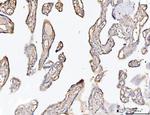 COL6A2 Antibody in Immunohistochemistry (Paraffin) (IHC (P))