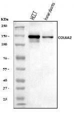 COL6A2 Antibody in Western Blot (WB)