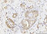 Nucleostemin Antibody in Immunohistochemistry (Paraffin) (IHC (P))