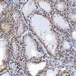 SPT5 Antibody in Immunohistochemistry (Paraffin) (IHC (P))