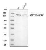 SPT5 Antibody in Western Blot (WB)