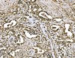 WAPL Antibody in Immunohistochemistry (Paraffin) (IHC (P))