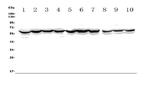 ASIC2 Antibody in Western Blot (WB)