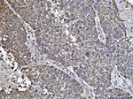 NDUFS5 Antibody in Immunohistochemistry (Paraffin) (IHC (P))