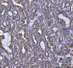 NDUFS5 Antibody in Immunohistochemistry (Paraffin) (IHC (P))