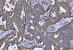 NDUFS5 Antibody in Immunohistochemistry (Paraffin) (IHC (P))