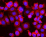 RPL10 Antibody in Immunocytochemistry (ICC/IF)