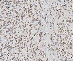 RPL10 Antibody in Immunohistochemistry (Paraffin) (IHC (P))