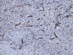 EHD3 Antibody in Immunohistochemistry (Paraffin) (IHC (P))