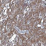 EHD3 Antibody in Immunohistochemistry (Paraffin) (IHC (P))