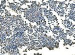 UBE2D1/2/3/4 Antibody in Immunohistochemistry (Paraffin) (IHC (P))