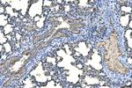 UBE2D1/2/3/4 Antibody in Immunohistochemistry (Paraffin) (IHC (P))