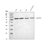 SLC5A7 Antibody in Western Blot (WB)