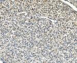 AKR1D1 Antibody in Immunohistochemistry (Paraffin) (IHC (P))