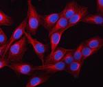 beta Tubulin Antibody in Immunocytochemistry (ICC/IF)