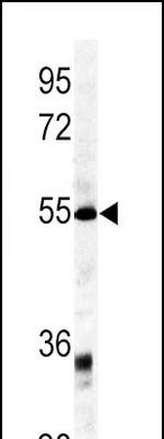 GDF6 Antibody in Western Blot (WB)