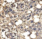 SRP72 Antibody in Immunohistochemistry (Paraffin) (IHC (P))