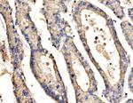 SRP72 Antibody in Immunohistochemistry (Paraffin) (IHC (P))