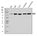 SRP72 Antibody in Western Blot (WB)