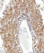 CEP250 Antibody in Immunohistochemistry (Paraffin) (IHC (P))