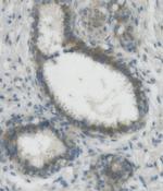 Nectin 2 Antibody in Immunohistochemistry (Paraffin) (IHC (P))