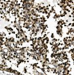 USP44 Antibody in Immunohistochemistry (Paraffin) (IHC (P))