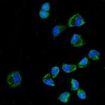 KLHL12 Antibody in Immunocytochemistry (ICC/IF)