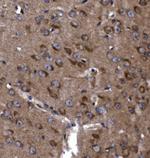 KLHL12 Antibody in Immunohistochemistry (Paraffin) (IHC (P))