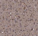 KLHL12 Antibody in Immunohistochemistry (Paraffin) (IHC (P))