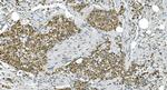 LSM7 Antibody in Immunohistochemistry (Paraffin) (IHC (P))