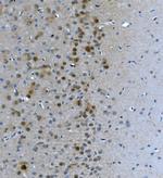 LSM7 Antibody in Immunohistochemistry (Paraffin) (IHC (P))