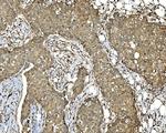 PDIR Antibody in Immunohistochemistry (Paraffin) (IHC (P))