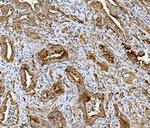 PDIR Antibody in Immunohistochemistry (Paraffin) (IHC (P))