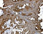 PDIR Antibody in Immunohistochemistry (Paraffin) (IHC (P))