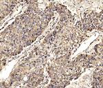 SCRN1 Antibody in Immunohistochemistry (Paraffin) (IHC (P))