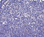 FKBP15 Antibody in Immunohistochemistry (Paraffin) (IHC (P))