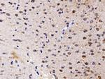 FKBP15 Antibody in Immunohistochemistry (Paraffin) (IHC (P))