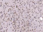 FKBP15 Antibody in Immunohistochemistry (Paraffin) (IHC (P))