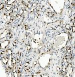 Nova-2 Antibody in Immunohistochemistry (Paraffin) (IHC (P))