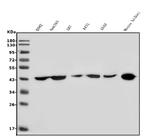 HOXD11 Antibody in Western Blot (WB)