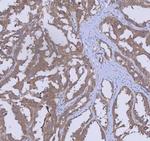 WDR44 Antibody in Immunohistochemistry (Paraffin) (IHC (P))