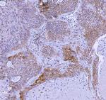 WDR44 Antibody in Immunohistochemistry (Paraffin) (IHC (P))