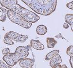 WDR44 Antibody in Immunohistochemistry (Paraffin) (IHC (P))