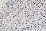 PSMD8 Antibody in Immunohistochemistry (Paraffin) (IHC (P))