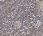 PSMD8 Antibody in Immunohistochemistry (Paraffin) (IHC (P))