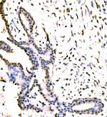 KIAA1429 Antibody in Immunohistochemistry (Paraffin) (IHC (P))