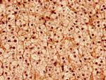 DDX3 Antibody in Immunohistochemistry (Paraffin) (IHC (P))