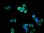 Cardiac Troponin I Antibody in Immunocytochemistry (ICC/IF)