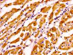 Cardiac Troponin I Antibody in Immunohistochemistry (Paraffin) (IHC (P))