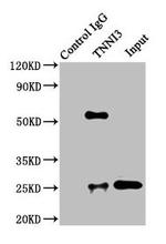 Cardiac Troponin I Antibody in Immunoprecipitation (IP)